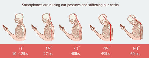 Soluvro - Intense Posture correcting